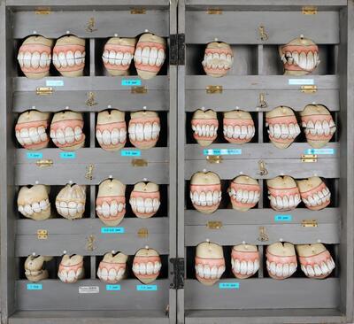 Kist met paardengebitten, gemaakt door dokter Louis Auzoux. COLLECTIE GENTS UNIVERSITEITSMUSEUM
