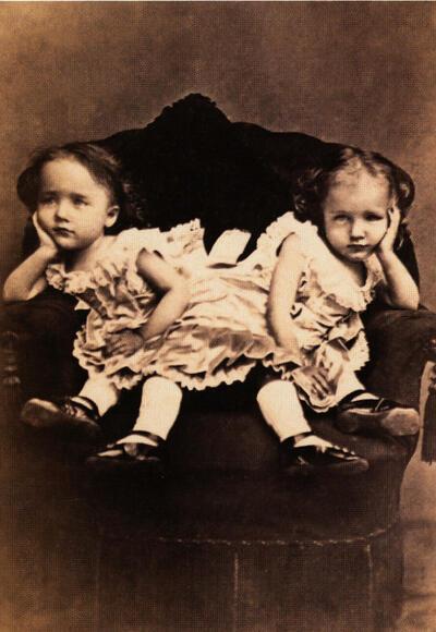 Anoniem, Siamese tweeling, ca. 1870, fotomuseum